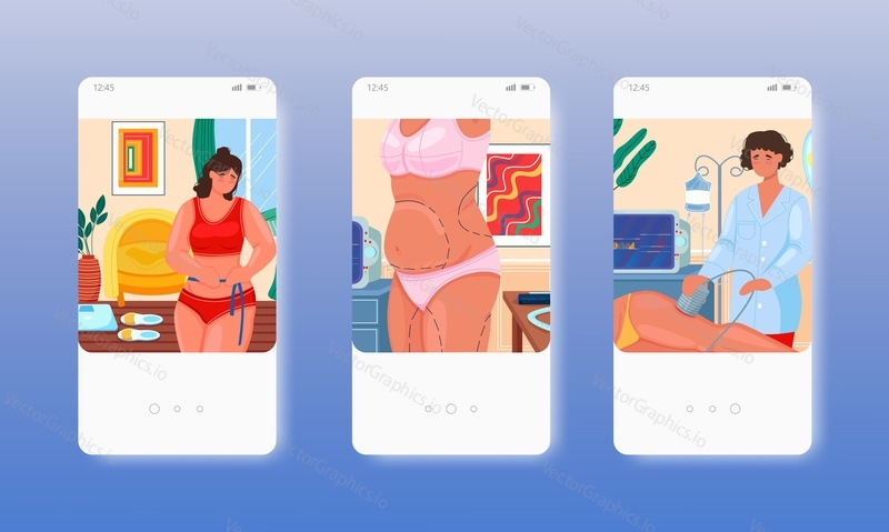 Ultrasound liposuction fat loss procedure. Ultrasonic cavitation. Cosmetic surgery. Mobile app screens. Vector banner template for website and mobile development. Web site and UI design illustration.