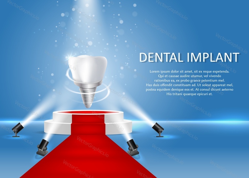Tooth implant on illuminated white round podium with red carpet. Vector realistic illustration. Dental implant poster banner template.