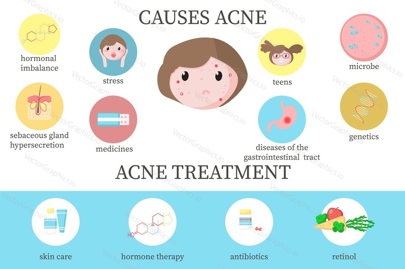 Acne causes and treatment diagram, vector flat style design illustration. Main factors cause acne and treatment from skin care to medical therapy infographics. Skin problems and dermatology.