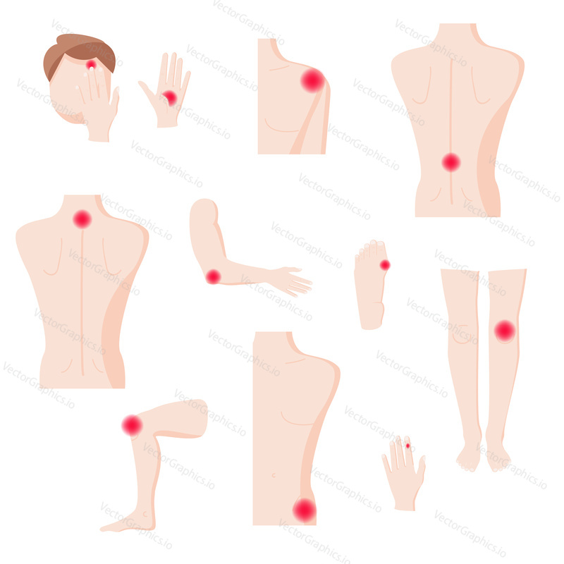 Части человеческого тела с болевыми зонами, векторная иллюстрация дизайна в плоском стиле. Области боли в голове, колене, локте, плече, спине, позвоночнике, кисти и фалангах пальцев.