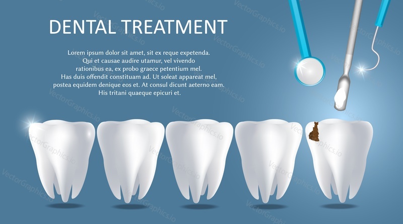Dental treatment vector medical poster banner template. Realistic human teeth and dentist tools. Dental restoration or filling concept.