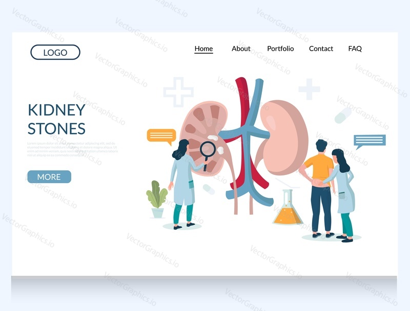 Kidney stones vector website template, web page and landing page design for website and mobile site development. Doctors examining patient kidney with magnifying glass. Urology, nephrology.