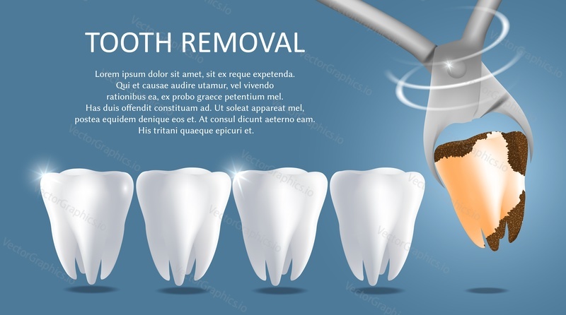 Tooth removal vector medical poster banner template. White healthy teeth and bad tooth extracted with dental pliers. Tooth extraction procedure, dental surgery concept.