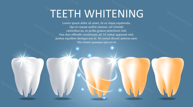 Teeth whitening vector medical poster banner template. Professional teeth bleaching, cleaning, oral hygiene.