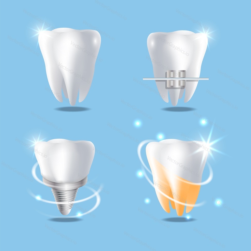 Dental services, vector isolated illustration. White brilliant healthy tooth, dental braces, implant and teeth whitening. Dentistry concept for poster, banner, website page etc.