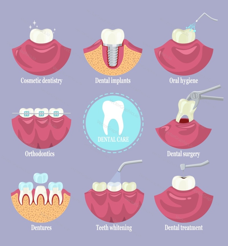 Dental care set, flat vector isolated illustration. Types of dentist clinic services. Cosmetic dentistry, dentures, orthodontics, teeth whitening, dental surgery, treatment and implants, oral hygiene.