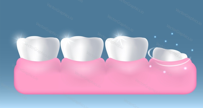 White healthy teeth and growing up new tooth, vector illustration. Stomatology, dentistry, dental health, oral hygiene,