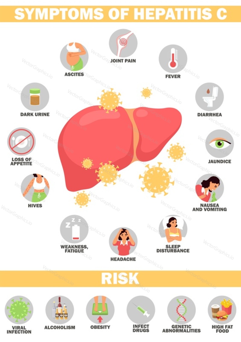 Векторная иллюстрация симптомов и риска гепатита. Медицинский плакат о лечении цирроза печени, брошюра о профилактике рака печени.