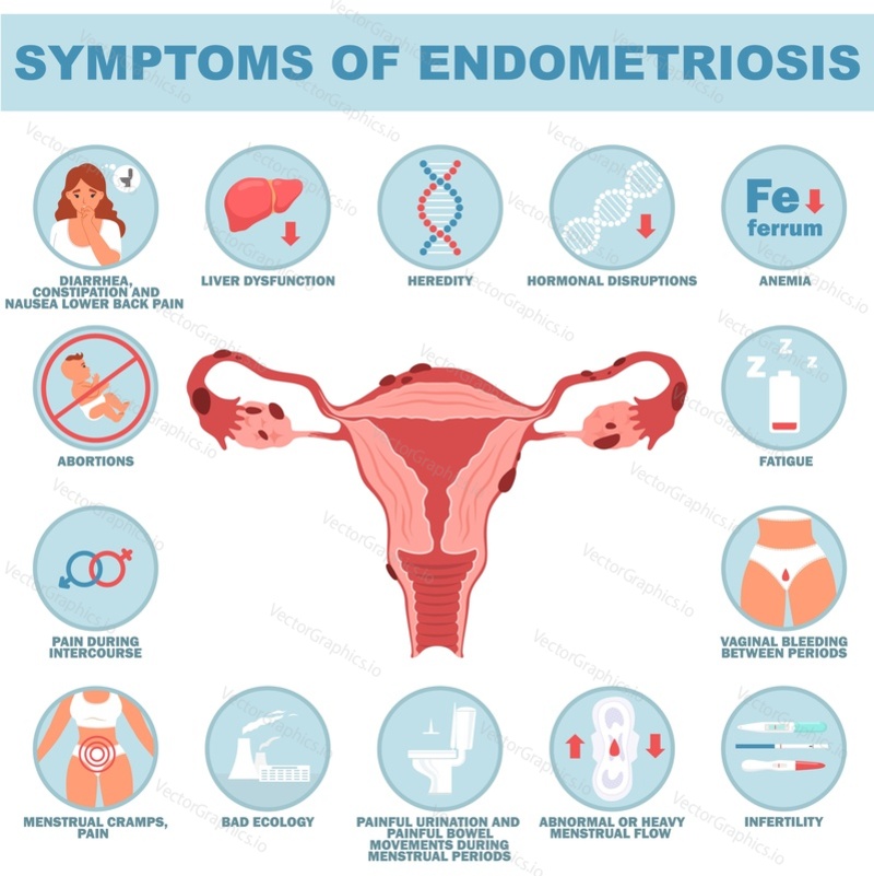 Symptom of endometriosis reproductive system disease medical vector illustration with sick woman and womb with endometrial elements outgrowth