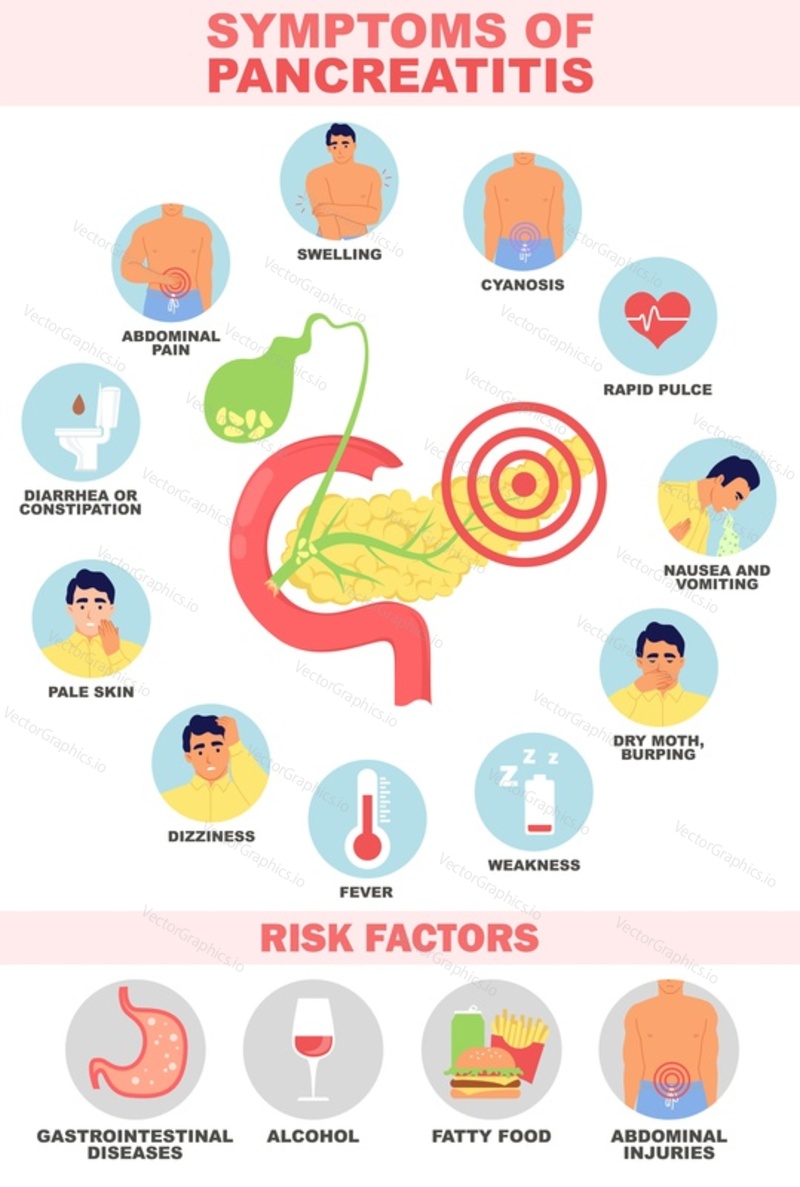 Векторная иллюстрация симптомов и факторов риска панкреатита. Медицинский плакат о заболеваниях органов пищеварения и брюшной полости