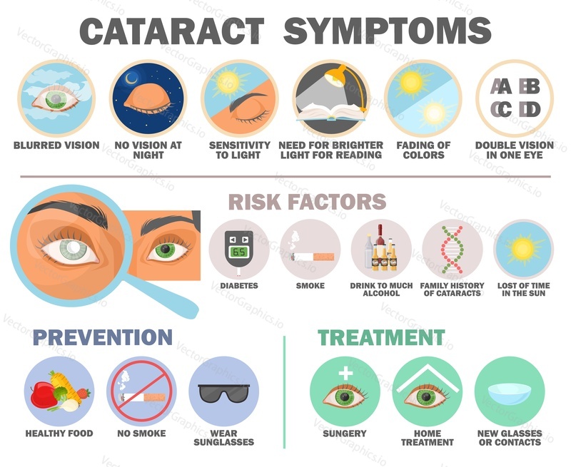 Cataract symptom, risk factor, prevention and treatment infographic vector medical poster illustration. Eye vision disease problem awareness and help
