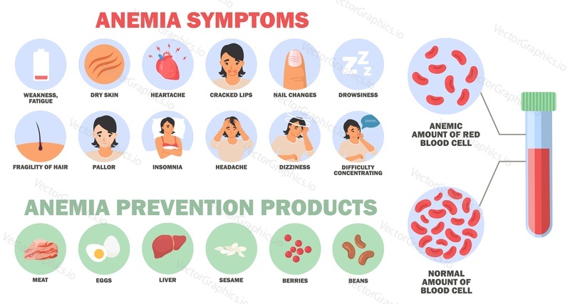 Anemia symptoms and prevention products infographic medical poster or info brochure. Vector illustration of blood disease due to iron deficiency