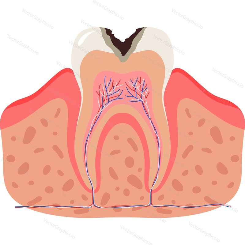 Дыра в зубе, векторный значок анатомии зубов, выделенный на белом фоне