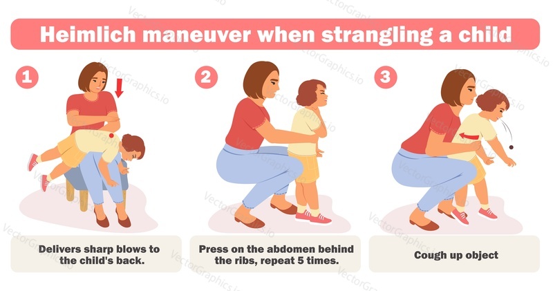 Векторная иллюстрация инфографического плаката с инфографикой о помощи ребенку при удушье. Неотложная помощь при искусственном дыхании для детей с затрудненным глотанием и дыханием из-за пищевой непроходимости.