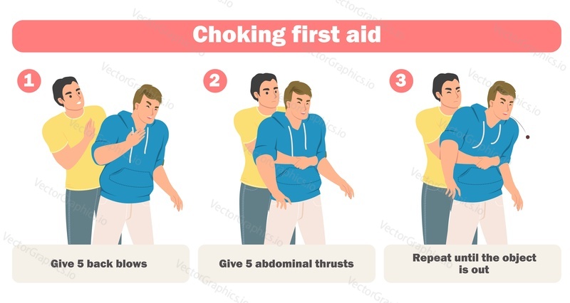 Choking first aid infographic poster with adults rescue emergency help. Stages of heimlich maneuver procedure, right position and abdominal thrusts actions instruction vector illustration